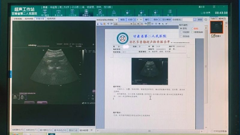 成都体检中心体检预约流程详解，轻松应对健康检查